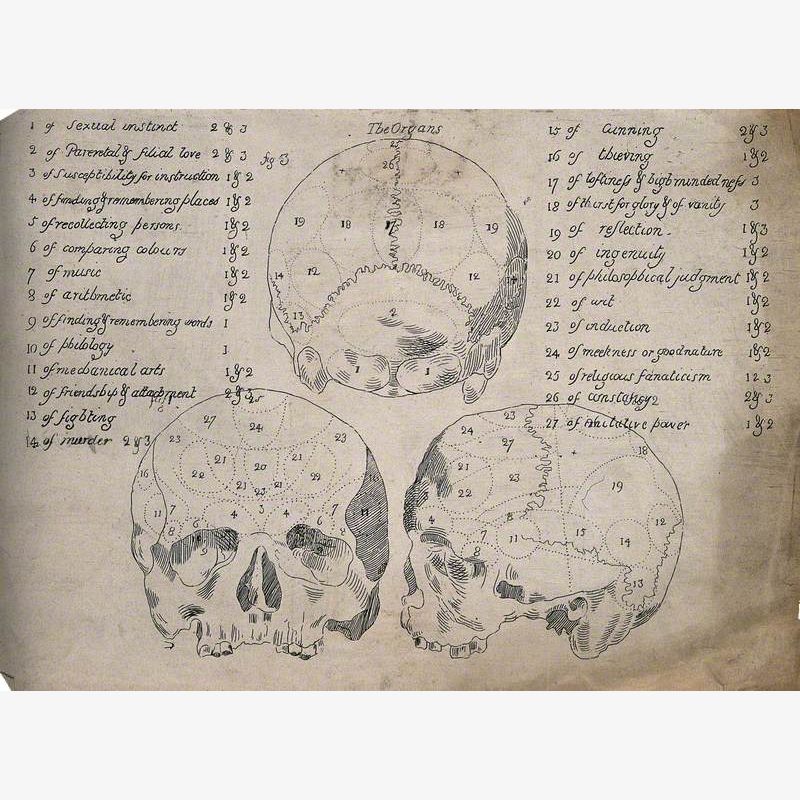 Three Perspectives of a Skull Sectioned and Labelled According to an Unorthodox System of Phrenology
